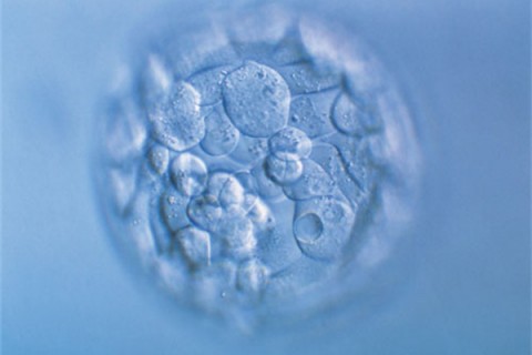 http://shijiazhuang.quanwangkm.com/post/190.html|石家庄人工试管